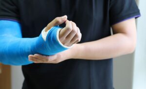 گچ گیری و آتل بندی در منزل کرج