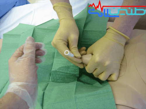 سونداژ مثانه در منزل کرج
